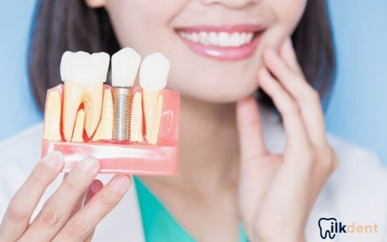 İstanbul İmplant Diş ile Sağlıklı Gülüşler