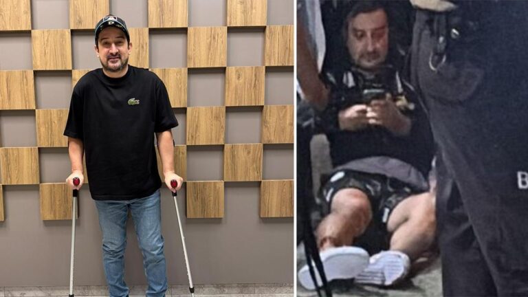 Yayından sonra ayağından vuruldu! Serhat Akın’dan 3 ay sonraki paylaşım…